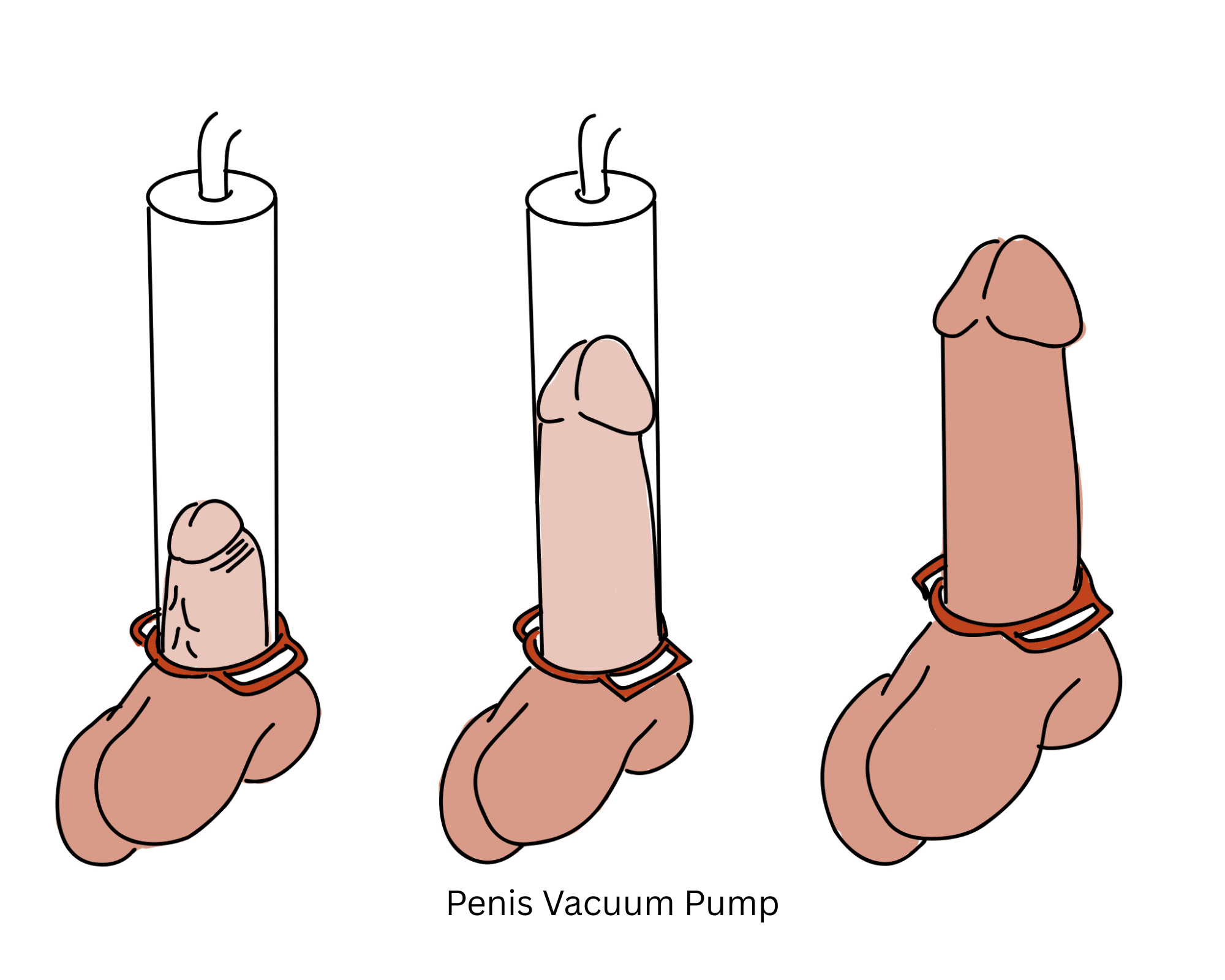 How Often Should You Use a Penis Pump