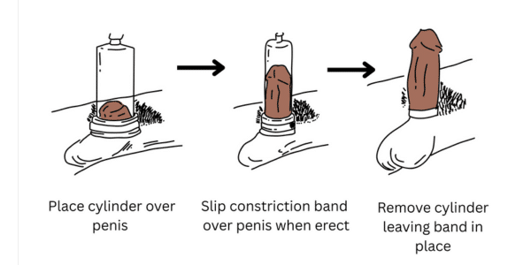 how to use penis pumps
